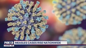 Measles cases rise nationwide