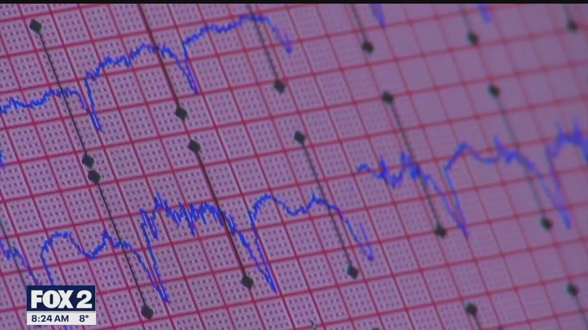 The Doctor Is In: The early signs of heart disease and how wearables can help detect heart irregularities