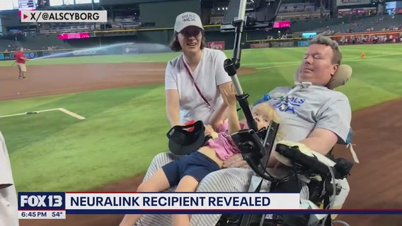 3rd Neuralink recipient revealed