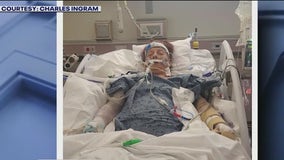 Woman critically injured in vicious dog attack