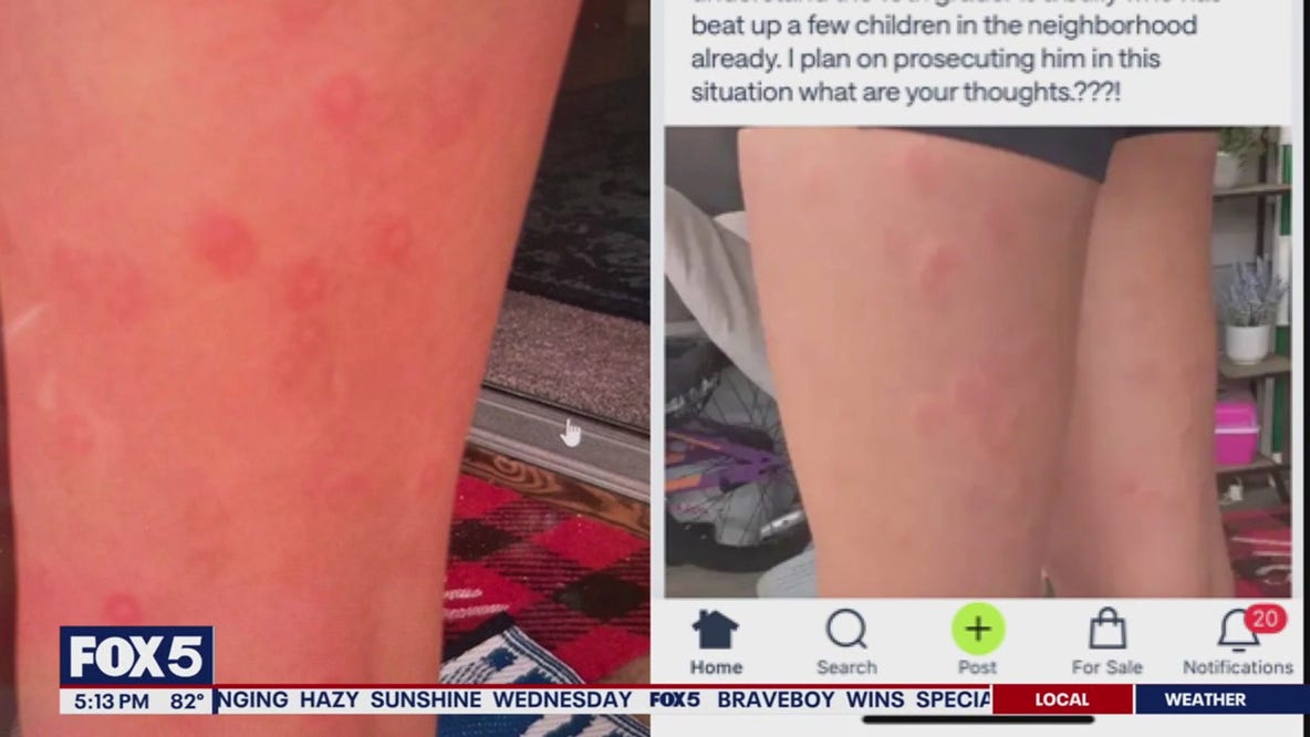 VA mom says daughter was injured by teens with 'gel blaster' guns