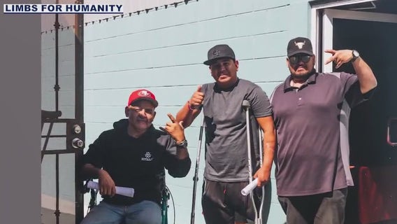 Limbs for Humanity give people a second shot at life