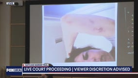 Sarah Boone's lawyer shows photo of alleged abuse