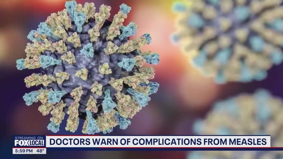 Doctors warn of complications from measles