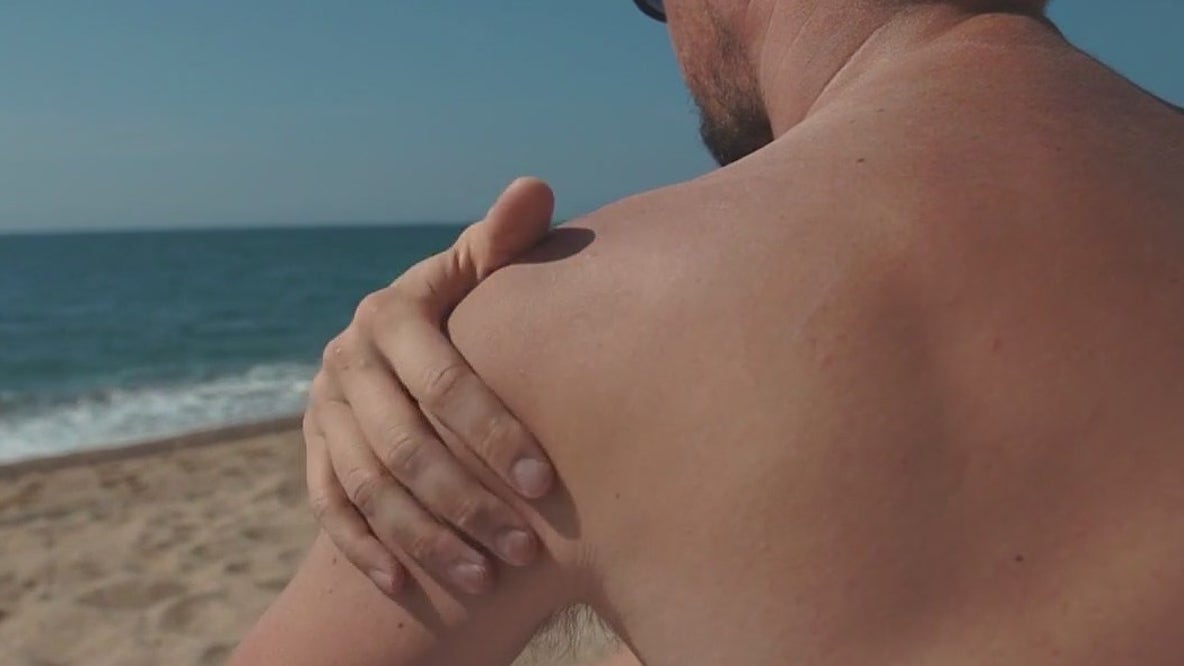 Doctor warns against 'anti-sunscreen' TikToks