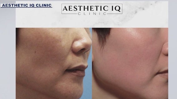 Skin brightening boot camp treats dark spots