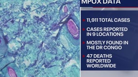 New strain of mpox found in California, first reported in US