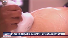 Extreme heat impacts on pregnant people