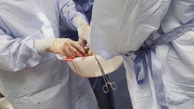 Henry Ford Health surgeons perform 1st beating-heart transplants in Michigan