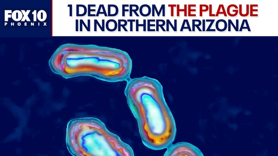 1 person dies of the plague in northern Arizona
