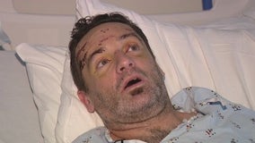 VTA assault victim talks about terrifying attack in San Jose