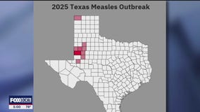 Texas child becomes first to die of measles in U.S. since 2015