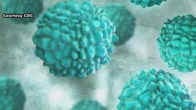 Norovirus cases on the rise