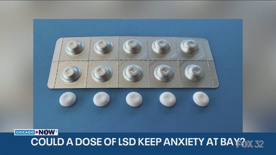 LSD for anxiety? Study finds one dose helps for months | ChicagoNOW
