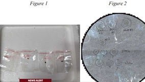 Chinese national tried smuggling pathogen through Detroit Metro Airport, Feds say