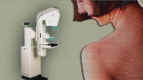 Breast cancer deaths down but occurrences up