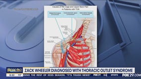 Dr. Mike breaks down Zach Wheeler's season-ending injury