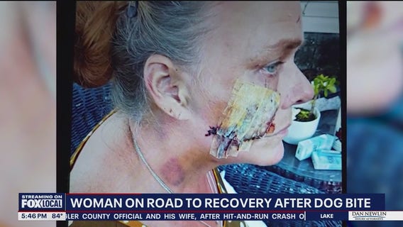Caregiver recovering after dog mauling in Cocoa faces long road to healing