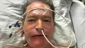 9/11 survivor gets cancer, needs jaw reconstruction