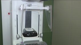 Mobile mammography units move across Bay Area