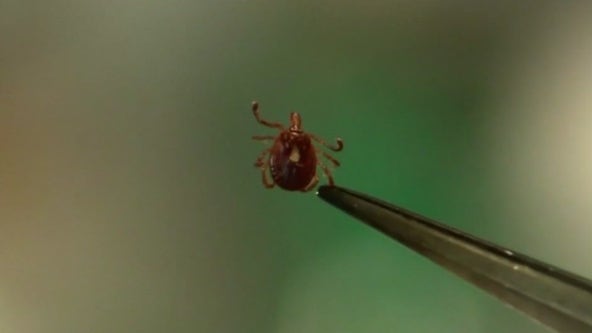 Emergency rooms seeing rise in tick bites