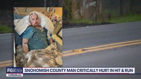 Snohomish Co. dad critically injured in hit-and-run crash