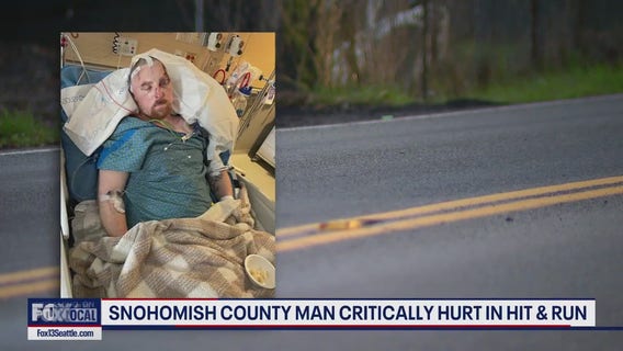 Snohomish Co. dad critically injured in hit-and-run crash