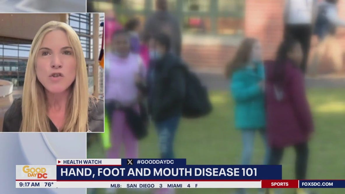 Hand, foot, and mouth disease 101