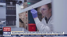 Allen Institute develops new blood draw technique