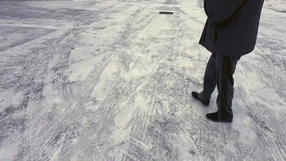 Cold weather got you itching? You might be allergic to winter