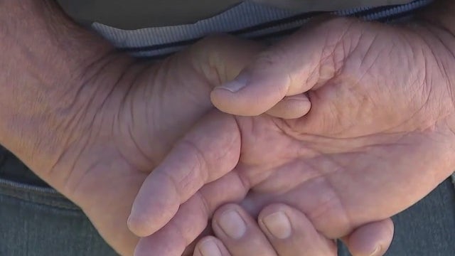 70-year-old tourist seriously injured in suspected e-bike hit-and-run, husband says