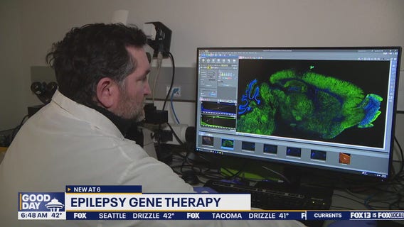 Breakthrough epilepsy gene therapy happening in Seattle