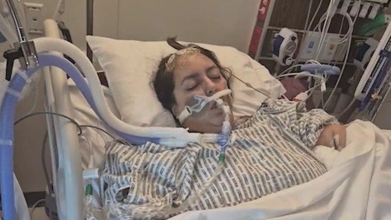 Florida family urges awareness after mother’s sudden brain aneurysm: 'Don't think, it's just a headache'