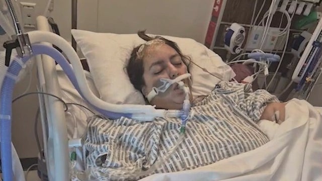 Florida family urges awareness after mother’s sudden brain aneurysm: 'Don't think, it's just a headache'