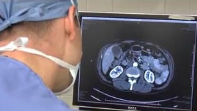 Montell Jordan's cancer is back: What should men look for?