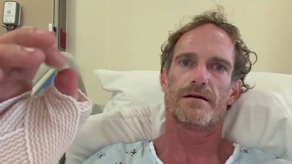 Surfer bitten by shark in New Smyrna calls recovery a 'miracle,' vows return to water