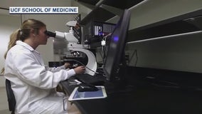 UCF gets funding for breast cancer research