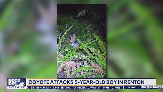 Coyote attacks 5-year-old boy in Renton, WA