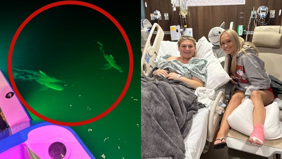 Two Central Florida women survive shark attack during weekend Bahamas trip