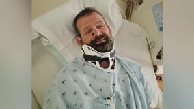 Man reflects after being shot in the head, walking over a mile to a friend’s house