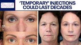 The truth about facial fillers | The Curious B