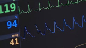Project ADAM combatting sudden cardiac arrest