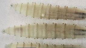 Screwworm threat in Austin: Gov. Abbott & Secretary Rollins on plans to fight back