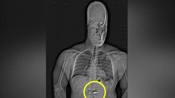 Man accused of swallowing luxury earrings