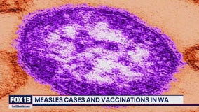 WA lagging behind in measles vaccinations