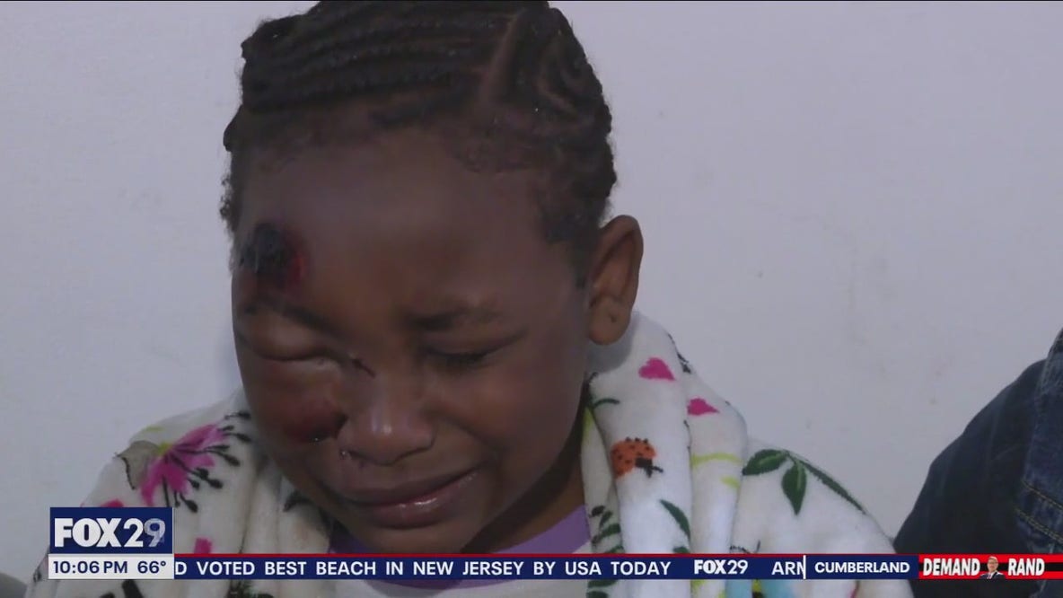 Girl, 11, victim of hit-and-run speaks out about her injuries