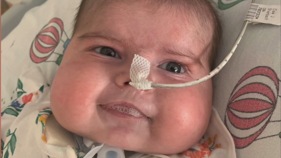 3-month-old daughter of 1st responders needs life-saving heart surgery