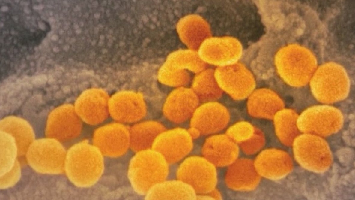 Study: People with Type A blood more likely to get COVID-19