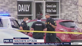 Police say machete-wielding man shot