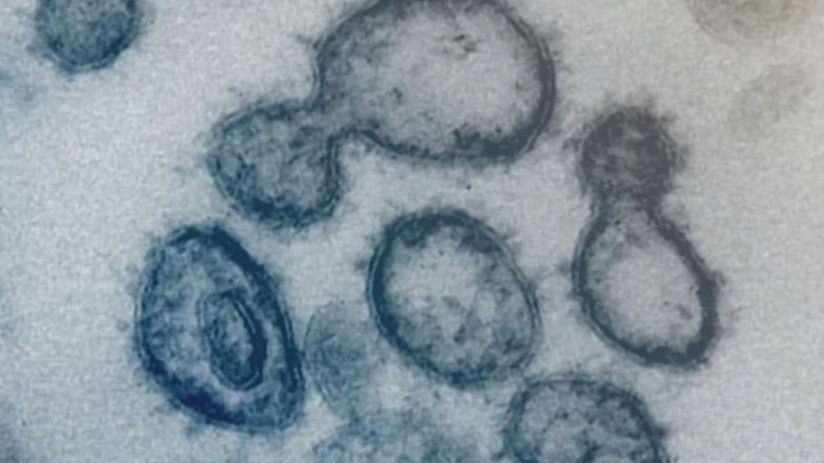 Virus variants in NYC